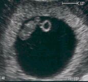 7 haftalk fetus